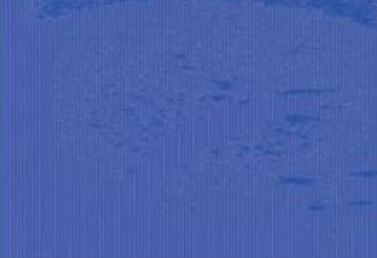 超音波RF信号画像